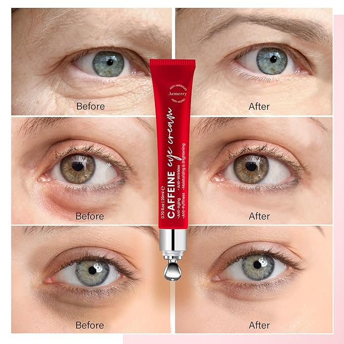 Caffeine Eye Cream Anti Aging: Eye Cream With Retinol, Sodium Hyaluronate, Vitamin E, For Dark Circles, Wrinkles, Puffiness & Fine Lines - Advanced Metal Applicator For Under Eye Bags And Puffy Eyes